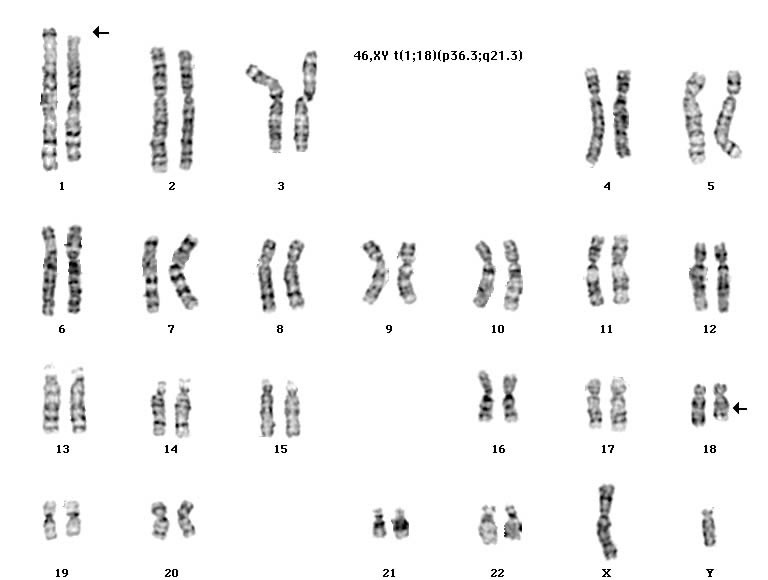 Sitogenetik Testler